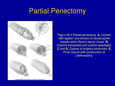 penectomy hentai|Pictures with tag(s): penectomy